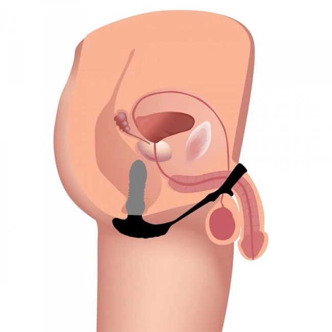 Thunderplugs 10x Thrusting Plug W/ Cock & Ball Ring - Vibration Modes and Thrusting Features